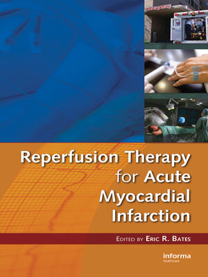 cover image of Reperfusion Therapy for Acute Myocardial Infarction